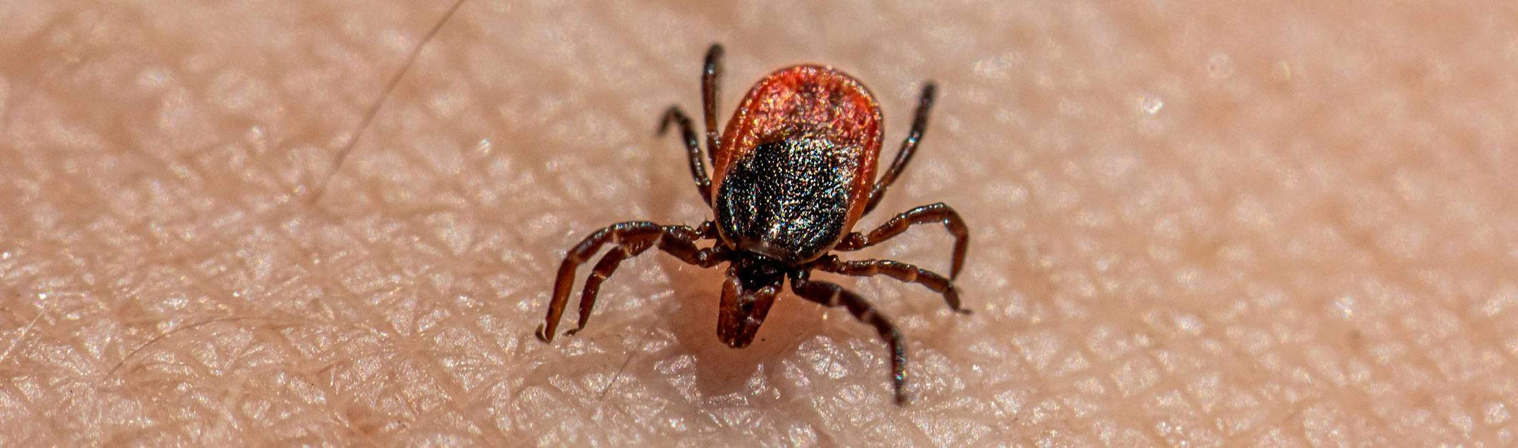 tick on human skin