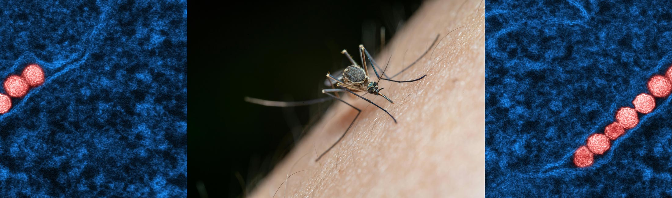 mosquito biting skin