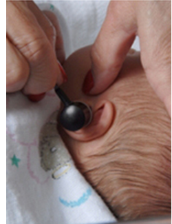 Newborn hearing screening test