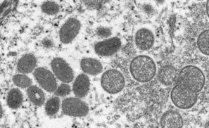Monkeypox virus under a microscope
