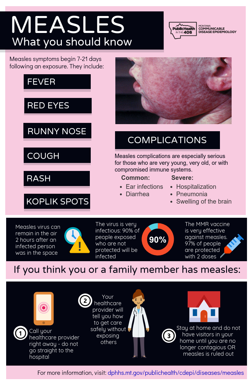Measles: what you should know